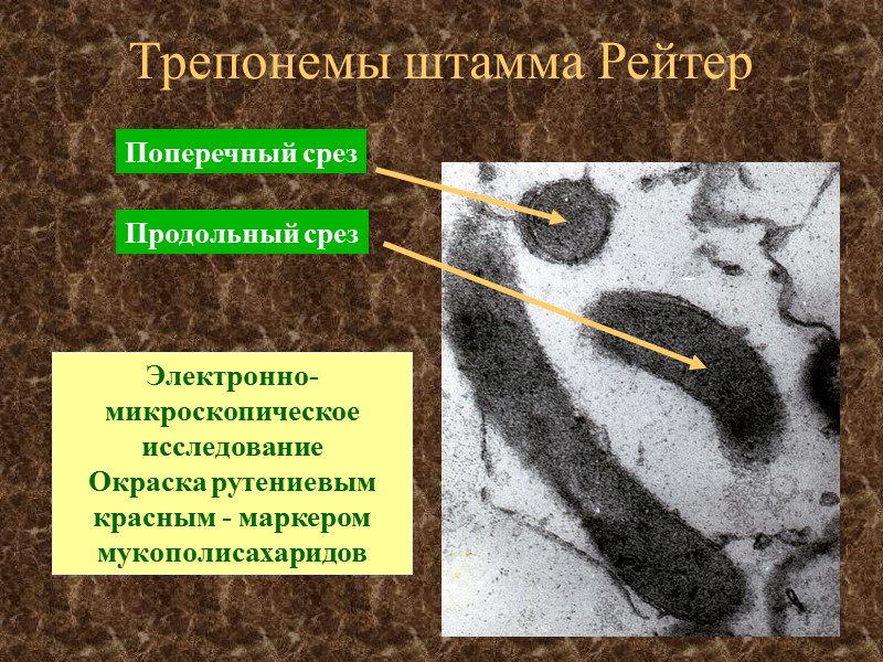 Трепонемы штамма Рейтер Электронно-микроскопическое исследование Окраска рутениевым красным - маркером мукополисахаридов Поперечный срез Продольный